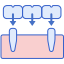 牙种植体 icon